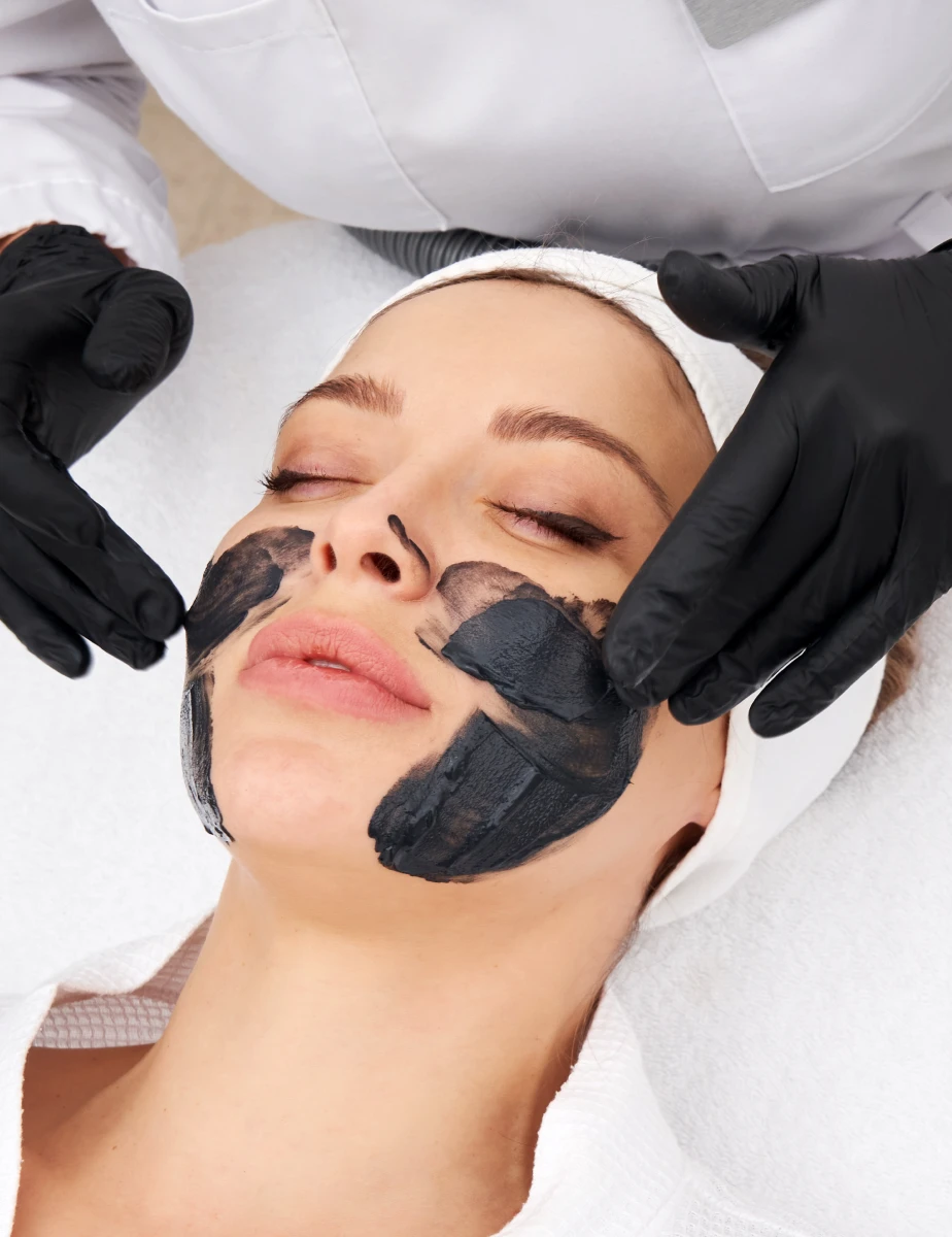 carbon peeling any haedo